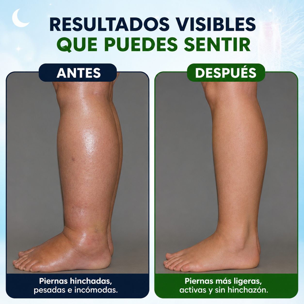 VenoPulse™ – EMS para piernas hinchadas desde casa